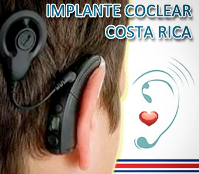 Implante Coclear Costa Rica